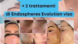 Dermapen: Promo da 8 trattamenti