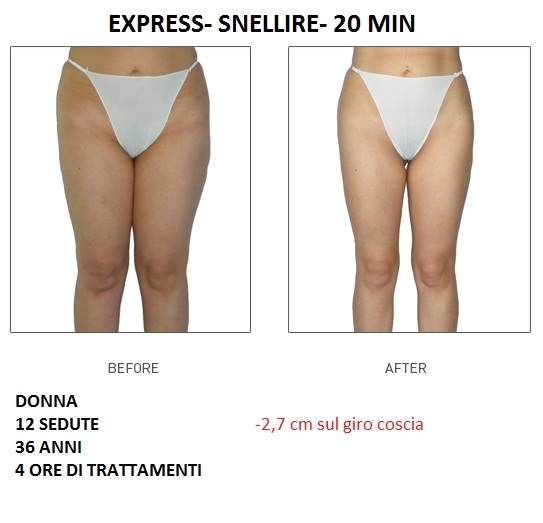 I risultati di LPG e alcune domande e risposte